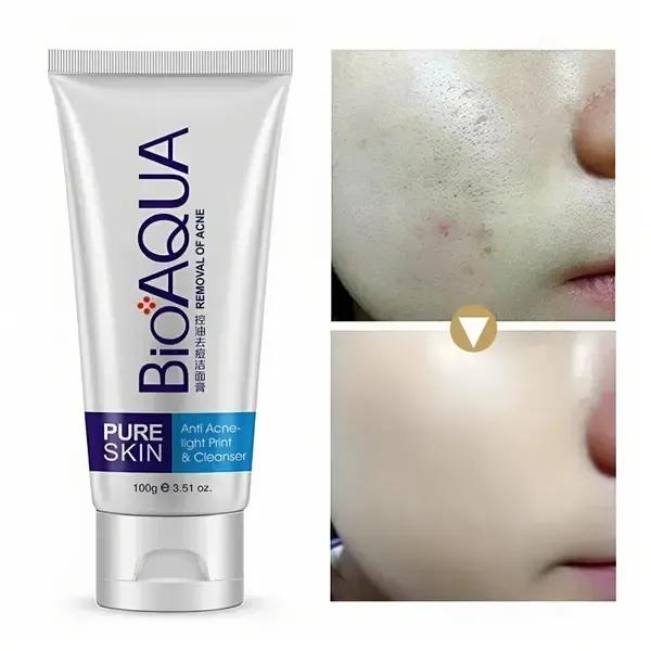BIOAQUA Removal of Acne Complete Set | Acne Cleanser, Acne Serum & Acne Cream