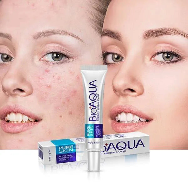 BIOAQUA Removal of Acne Complete Set | Acne Cleanser, Acne Serum & Acne Cream