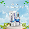 BIOAQUA Removal of Acne Complete Set | Acne Cleanser, Acne Serum & Acne Cream